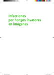Infecciones por hongos invasores en imágenes