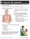 El cáncer de pulmón Hoja informativa