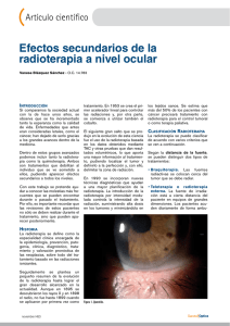 Efectos secundarios de la radioterapia a nivel ocular