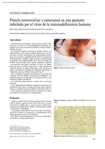 Fístula enterovulvar y enteroanal en una paciente infectada por el