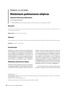 Metástasis pulmonares atípicas - Instituto Nacional de Cancerologia