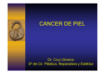CANCER DE PIEL