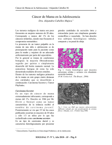 CANCER DE MAMA EN ADOLESCENCIA
