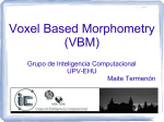 Voxel Based Morphometry (VBM)