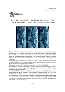 ESTUDIO DE METÁSTASIS ESQUELÉTICAS CON TUMOR