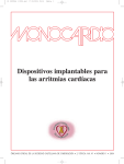 Dispositivos implantables para las arritmias cardíacas