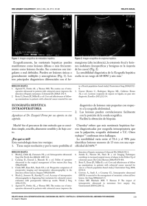 Ecograficamente, las metástasis hepaticas pueden manifestarse