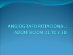ANGIÓGRAFO ROTACIONAL CON ADQUISICIÓN DE TC Y 3D