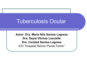 OK Tuberculosis ocular