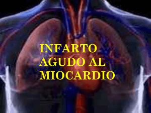 Infarto Agudo al Miocardio