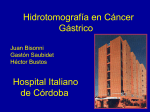 Hidrotomografía en cáncer gástrico