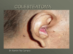 colesteatoma - Doctor Ramón Paz Campos