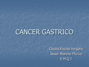 cancer gastrico