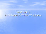 Gingivitis ulceronecrotizante 2004