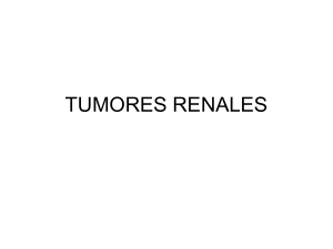 Tumores renales Archivo