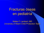 no rib fractures