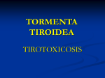tormenta tiroidea