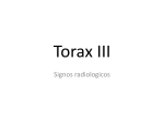 Torax III - eTableros