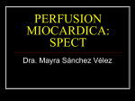 perfusion miocardica - ELECTROCARDIOGRAFIA