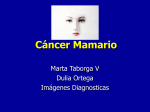 Cancer mamario - diagnosticos por imagenes,biopsias,mamografias
