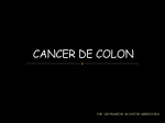 CANCER DE COLON