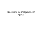 Procesado de imágenes con PCNN