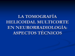 la tomografía helicoidal multicorte en neurorradiología: aspectos