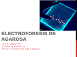 Electroforesis horizontal (agarosa)