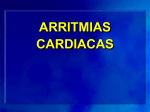 arritmias cardíacas eef, rf, mapeos