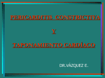 pericarditis constrictiva - medicina
