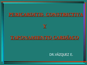 pericarditis constrictiva - medicina