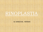 rinoplastia - Blogs de la Gente