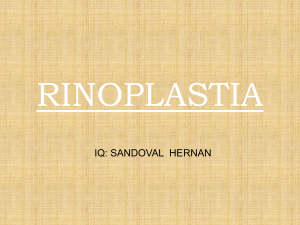 rinoplastia - Blogs de la Gente