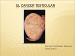 el cancer testicular - Christopher Espinoza Araya
