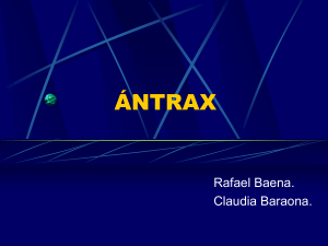 antrax - OdontoChile