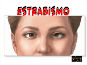 Estrabismo - PPsHot.com