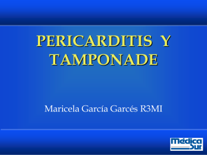 pericarditis y tamponade