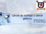 Cáncer de esófago y cáncer gástrico. Interna Burgos.