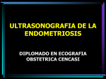 Clase 3.- ULTRASONOGRAFIA DE LA ENDOMETRIOSIS