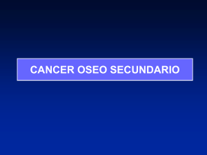 Cáncer Óseo Secundario - lerat
