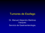 Tumores-de-Esofago