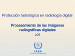 05. Procesamiento de las imágenes radiográficas - RPoP