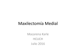 Maxilectomía Medial