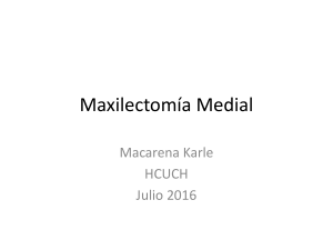 Maxilectomía Medial