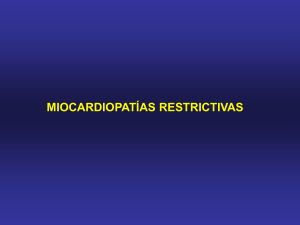 miocardiopatías restrictivas