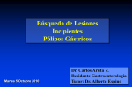 Búsqueda de Lesiones Incipientes Pólipos Gástricos