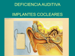 IMPLANTES COCLEARES