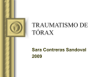 traumatismo de tórax