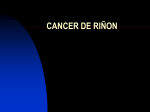 CANCER DE RIÑON Introducción