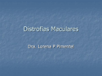 distrofias maculares - Punto de Encuentro Oftalmológico